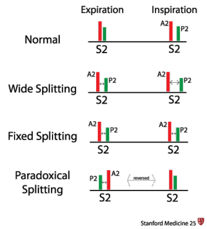 Splitting of S2