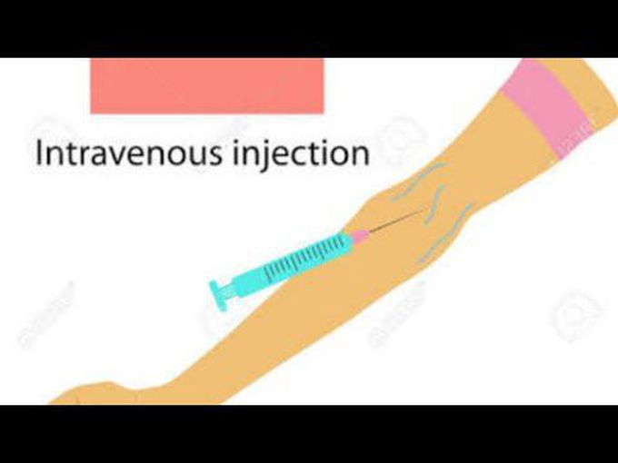 Intravenous route of drug administration-detailed description