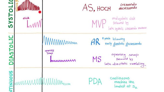 Heart Murmurs Visual Illustration