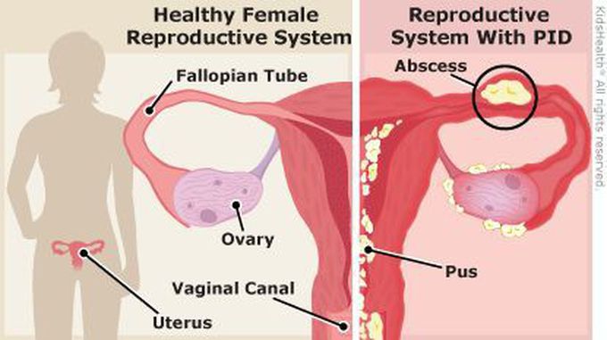 Female reproductive barriers...!!!