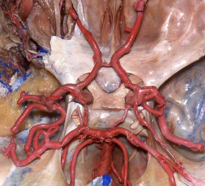 Circle of Willis