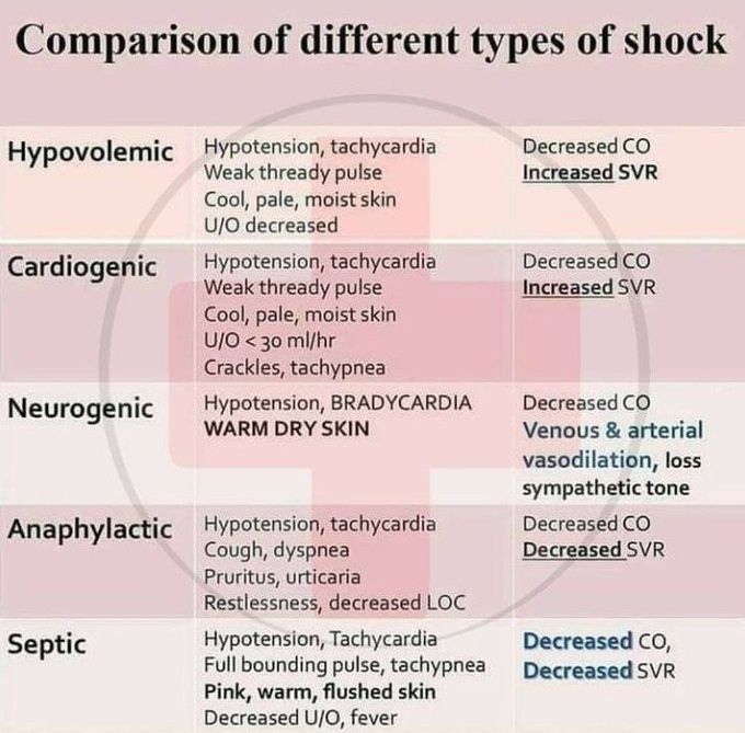 Comparison of different types of shock