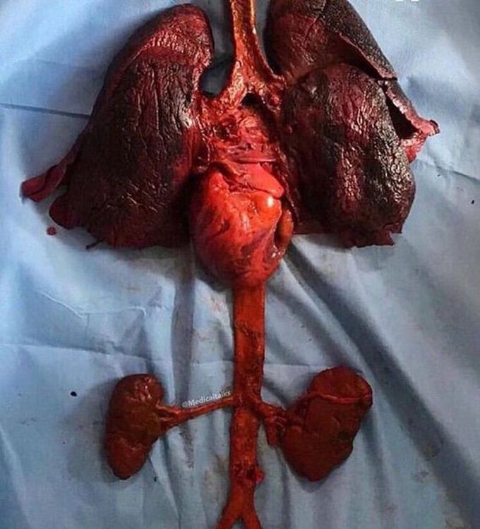 Smoker organs