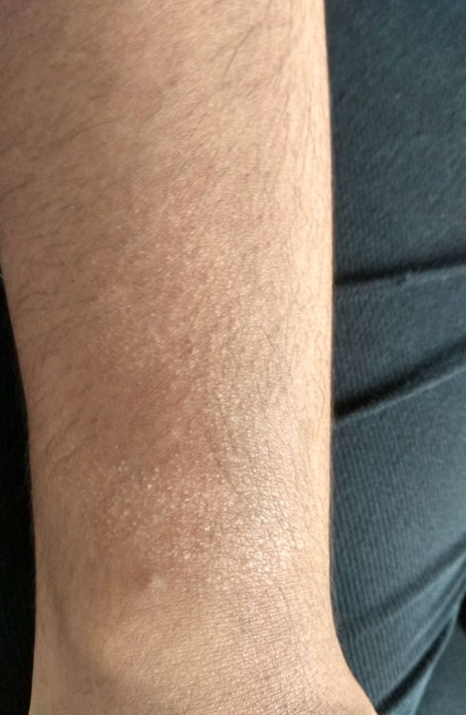Diagnosis ??