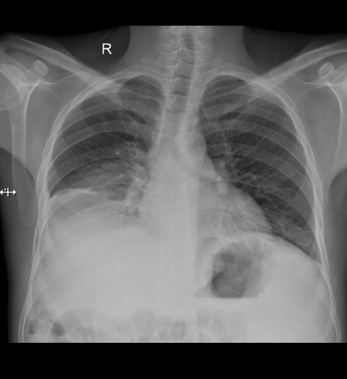 Diagnosis?