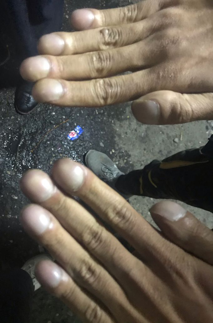 Big finger