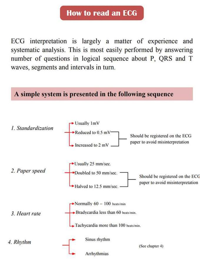 Ecg reading summary tips.