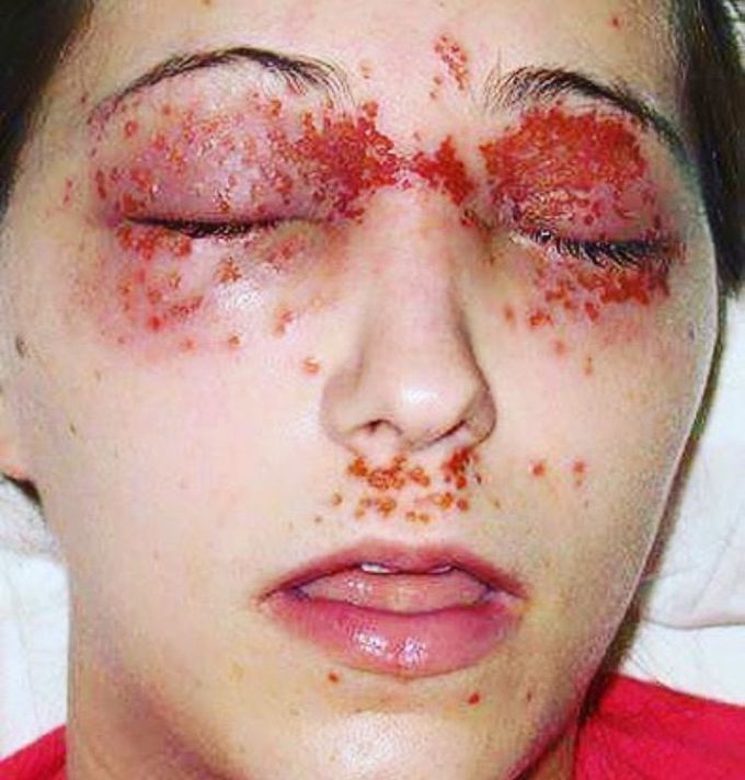What is your diagnosis??