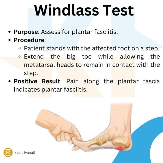 Windlass Test