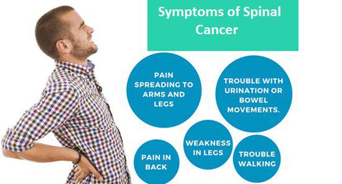 Symptoms of spinal cancer