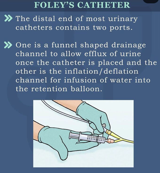 Foley's Catheter II