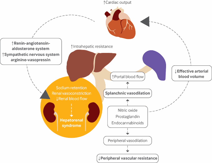 Hepatorenal syndrome