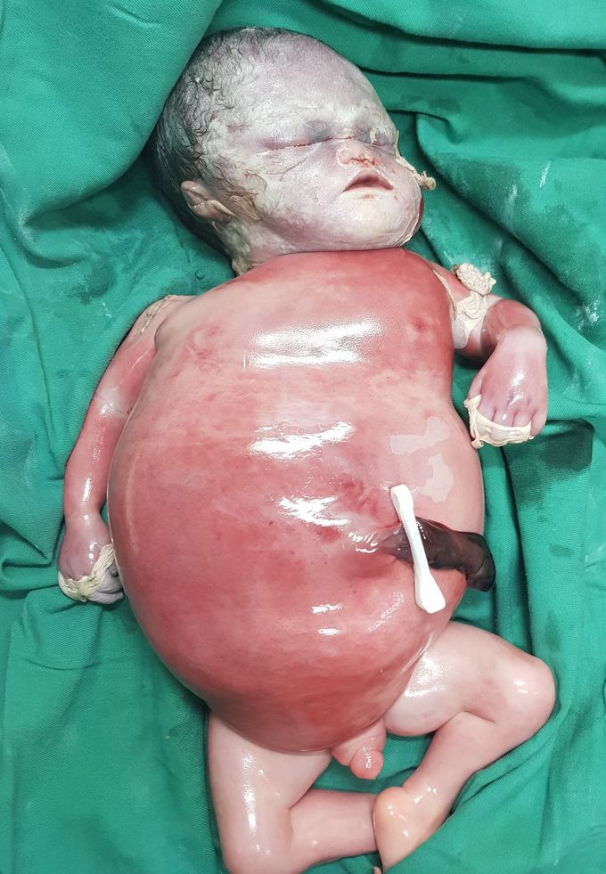 What is your diagnosis?
