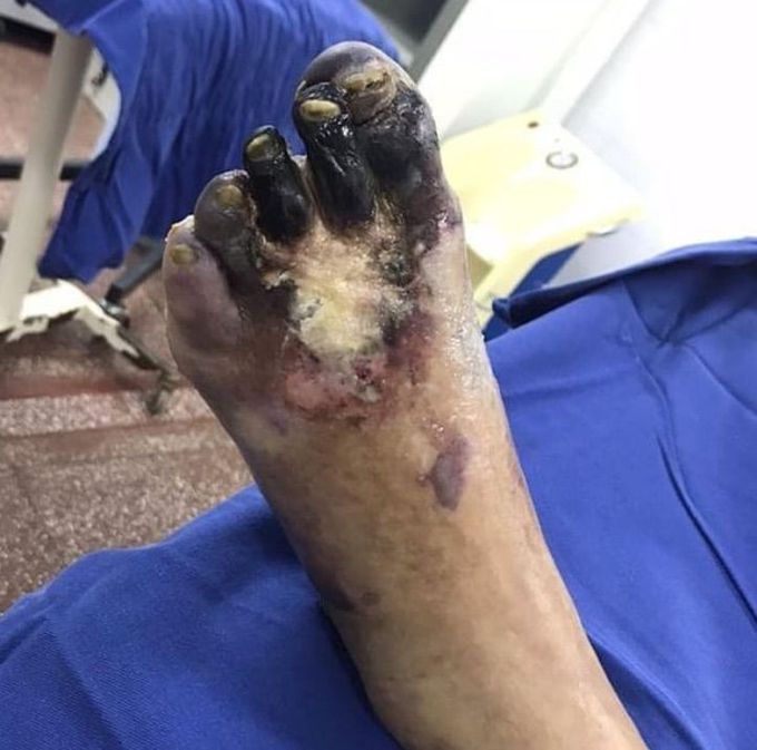 Diagnosis??