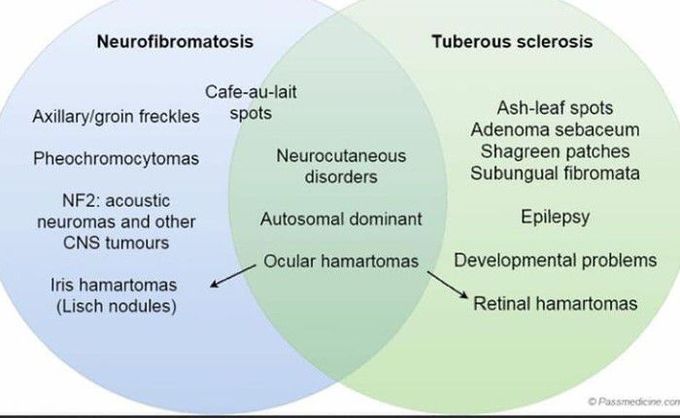 Neurofibromatosis Vs Tuberous Sclerosis