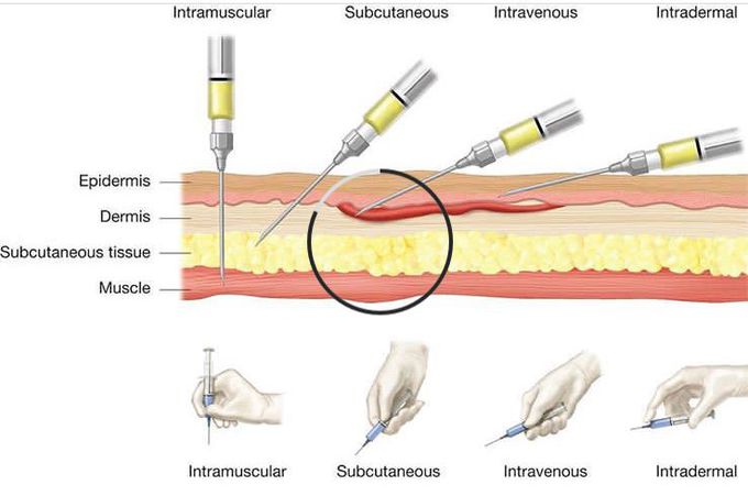 Injection techniques