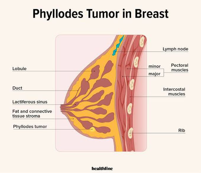 Breast Anatomy - MEDizzy