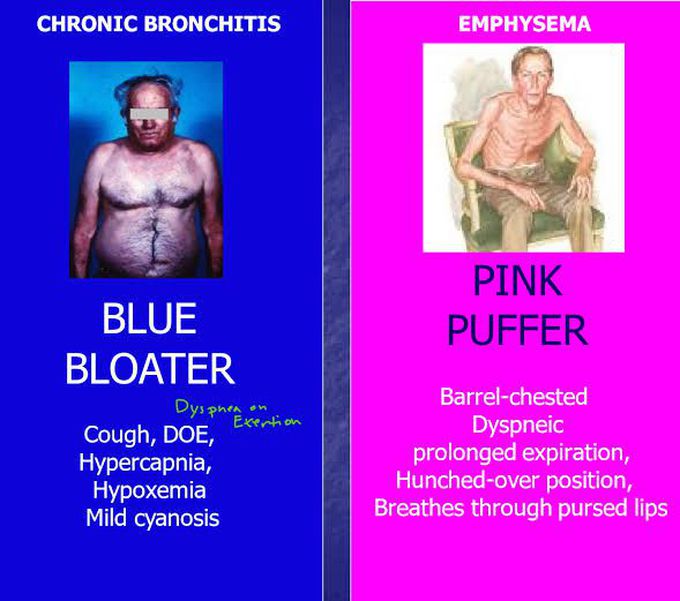 BLUE BLOATER vs PINK PUFFER