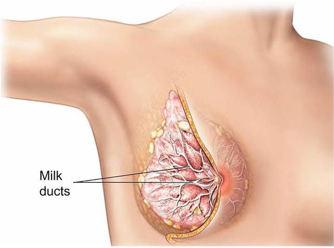 Causes of duct ectasia