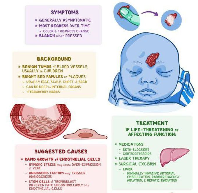 Causes of hemangioma
