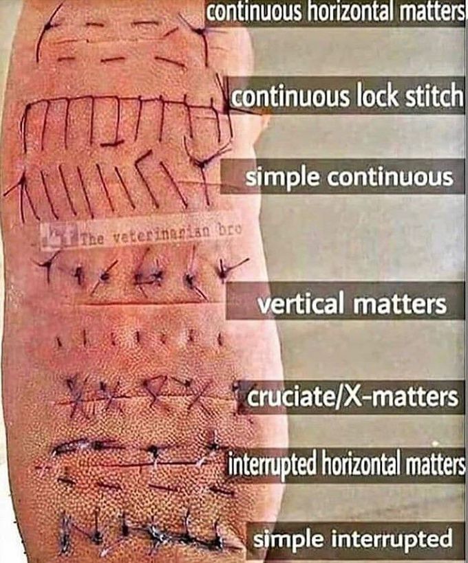 Types of sutures