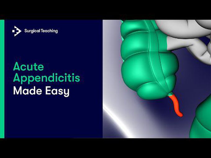 Appendicitis: Surgical Overview