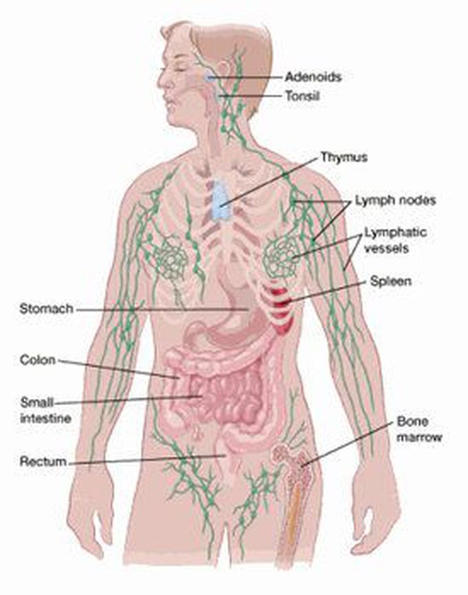 Hodgkin's lymphoma
