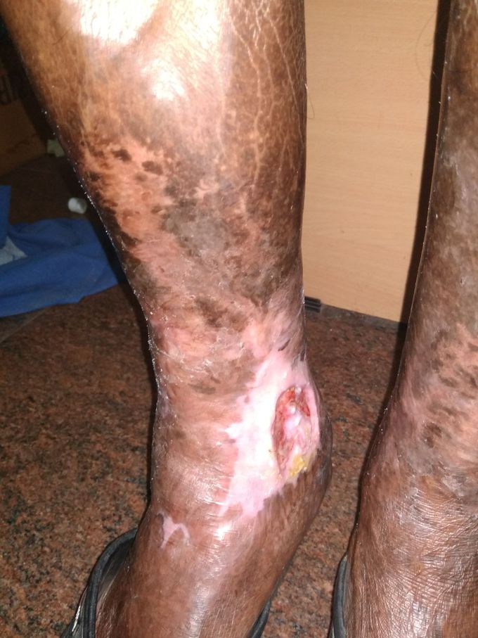 Diagnosis?