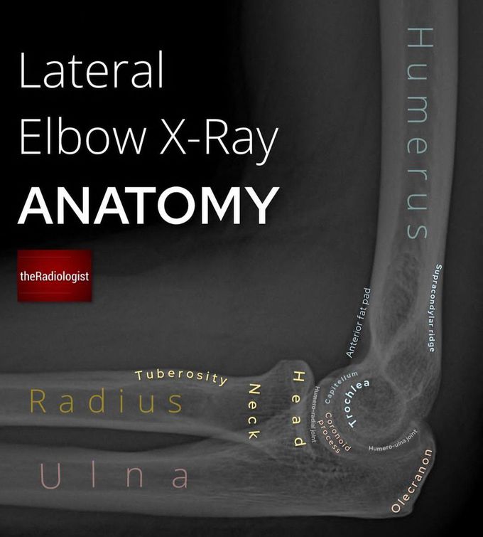 Elbow X-ray Anatomy