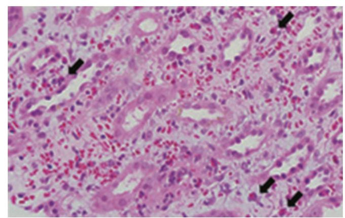 Renal question of the day