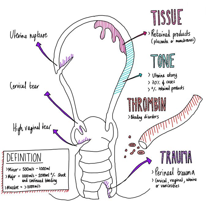 Postpartum Haemorrhage