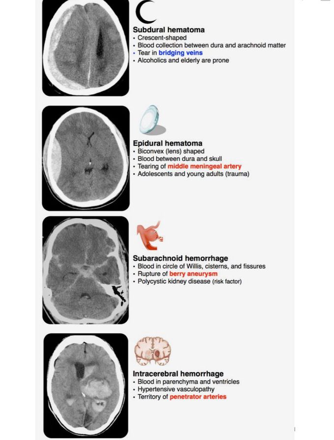 Hematoma, Hemorrhage