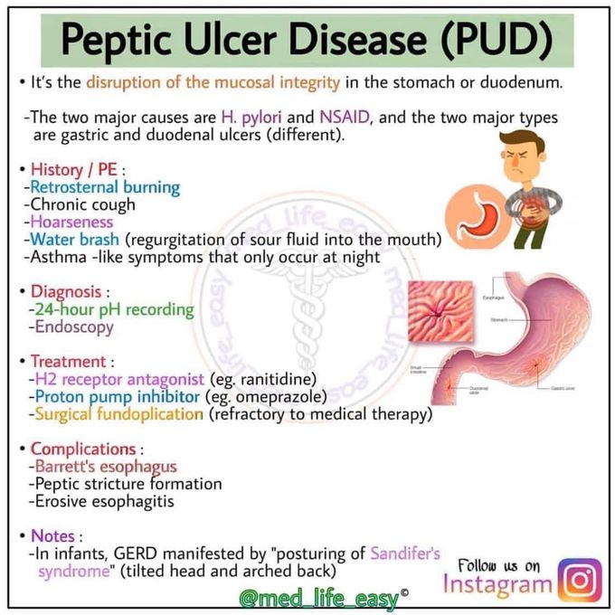 Peptic ulcer