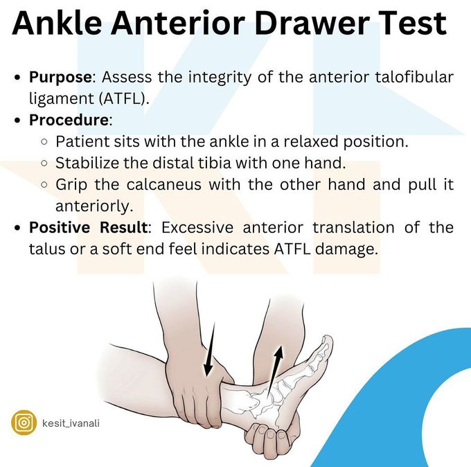 Ankle Anterior Draw Test