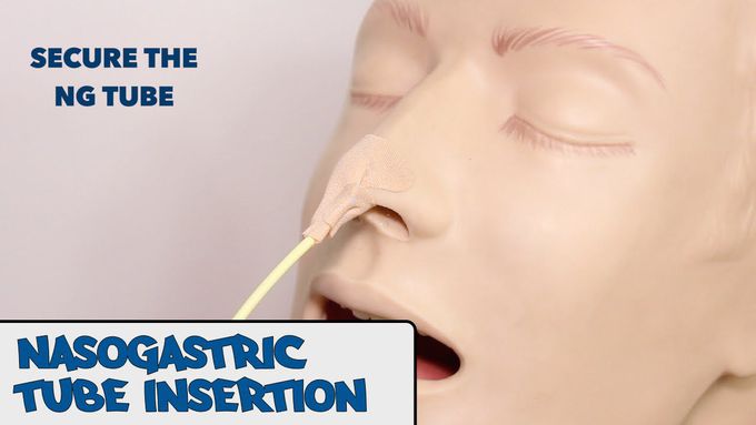 Nasogastric (NG) Tube Insertion - OSCE Guide
