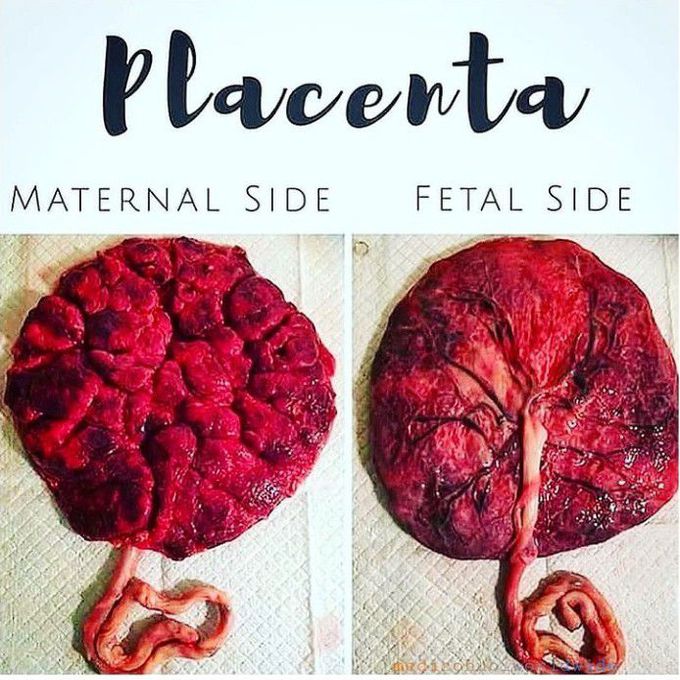Maternal and fetal sides of placenta