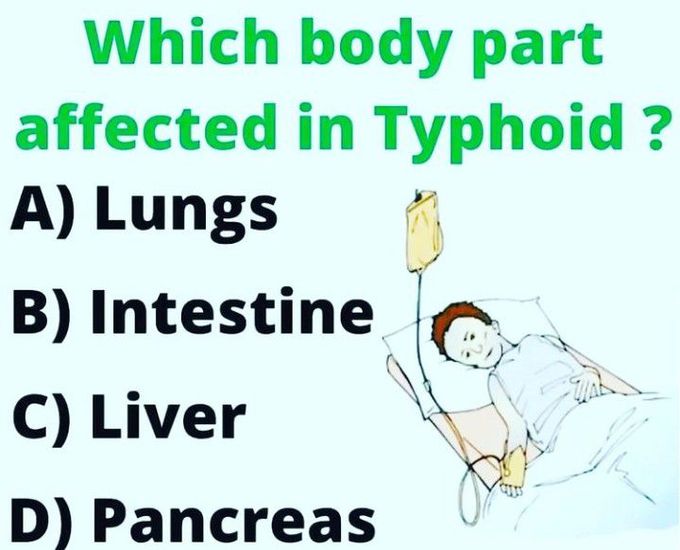 Which body part is affected in Typhoid?