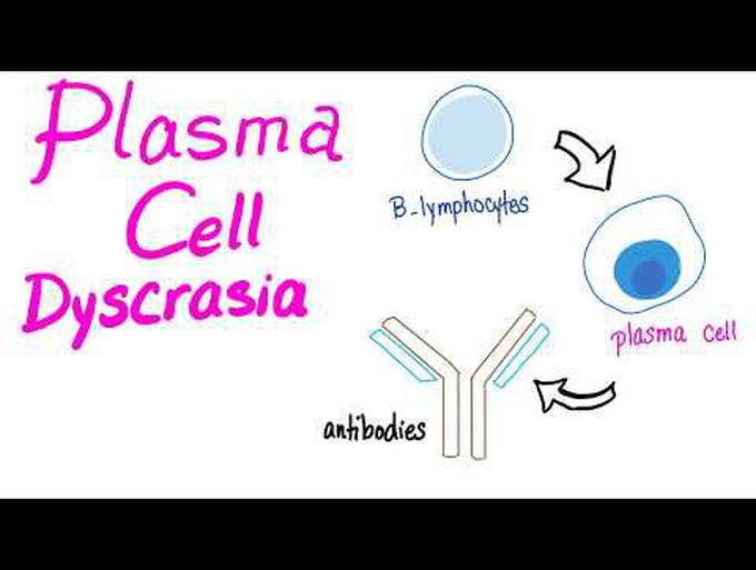 Plasma Cell Dyscrasias (an intro to Multiple Myeloma)