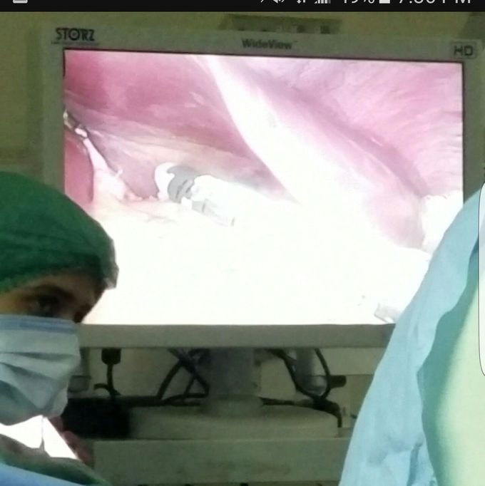 Gastrectomy