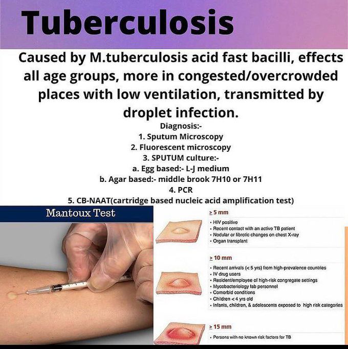 Tuberculosis and tuberculin skin test