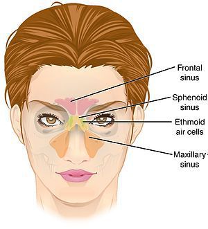 Sinuses - MEDizzy