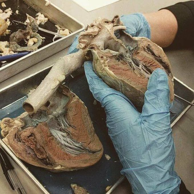 another day, another dissection