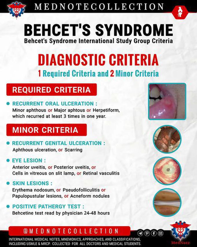 🧠 BEHCET'S SYNDROME