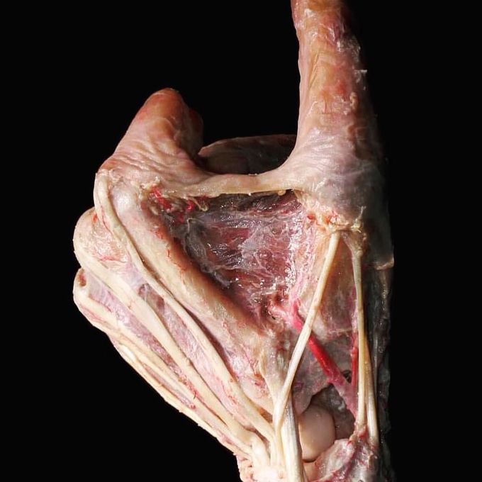 A hand with no skin! What a shot. 