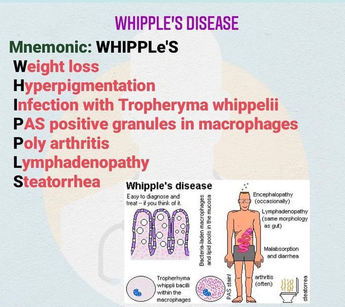 Whipple's Disease - Mnemonic