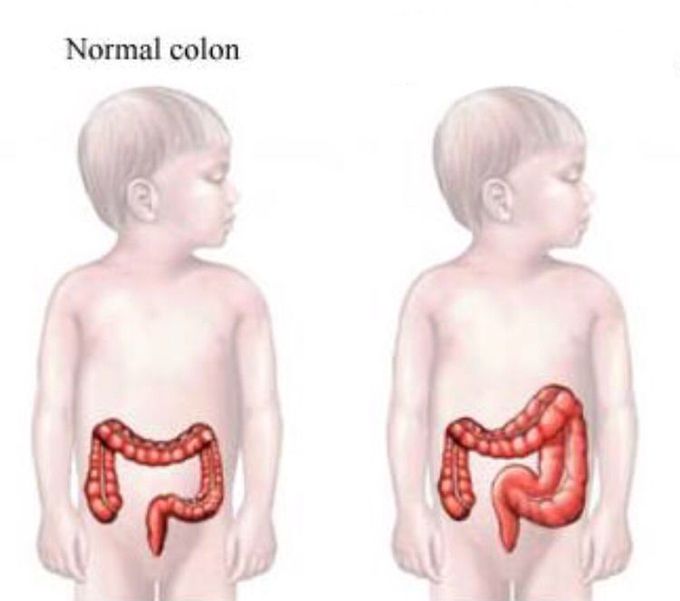 🔸 Guess the diagnosis !!