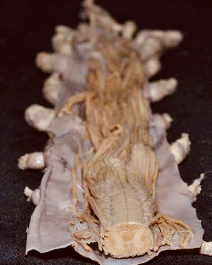 Spinal cord