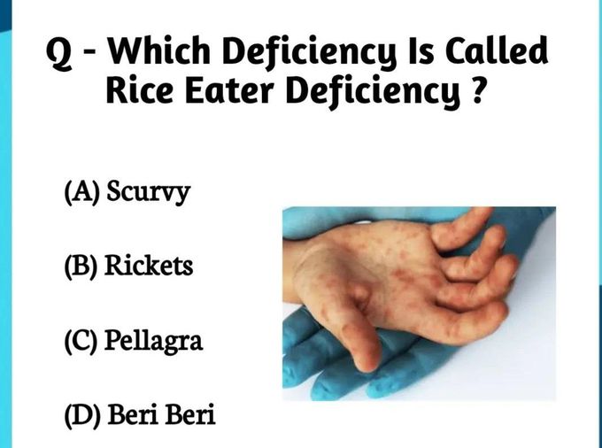 Eice Eater Deficiency