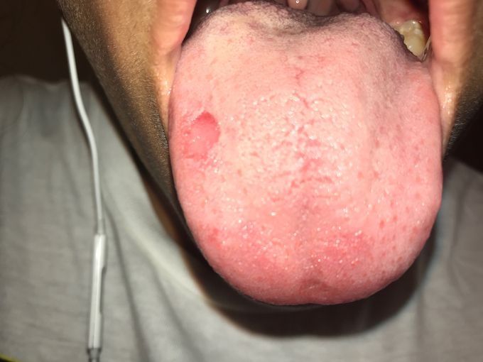 What is this???