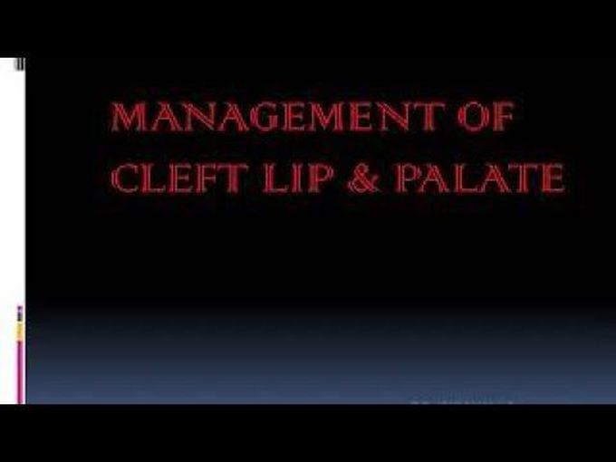 Cleft Lip and Palate: Management